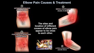 Elbow Pain Causes &amp; Treatment - Everything You Need To Know - Dr. Nabil Ebraheim