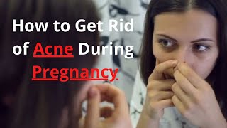 How to Get Rid of Acne During Pregnancy - Acne During Pregnancy Treatment