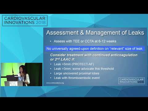 CVI2018 Session: Limits for transcatheter LAA closure - Jacqueline Saw, MD
