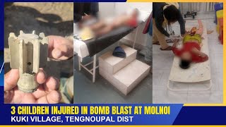 Download lagu 3 CHILDREN INJURED IN BOMB BLAST AT MOLNOI KUKI VILLAGE, TENGNOUPAL DIST | 20 DEC 2025 mp3