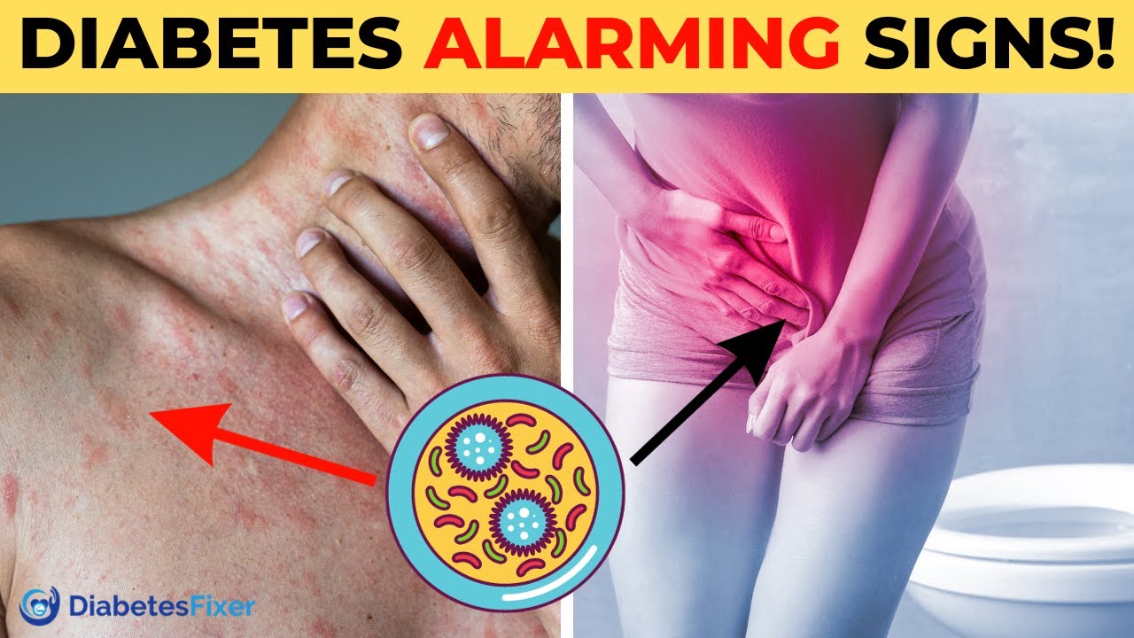 10 Signs Your Blood Sugar Is High