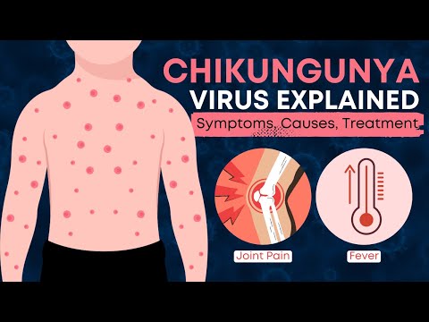 What is Chikungunya Virus? | All You Need to Know About Chikungunya Virus