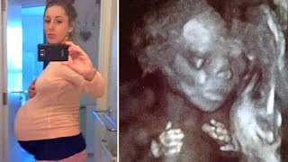 Young Surrogate Carries Couple’s Child, Then They Look Closer At The Scan And Freeze