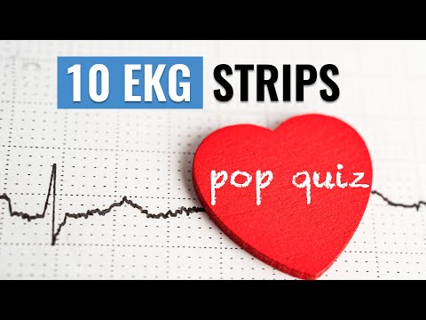 10 EKG Strips POP QUIZ for the NGN NCLEX- RN | NAME that Heart Rhythm
