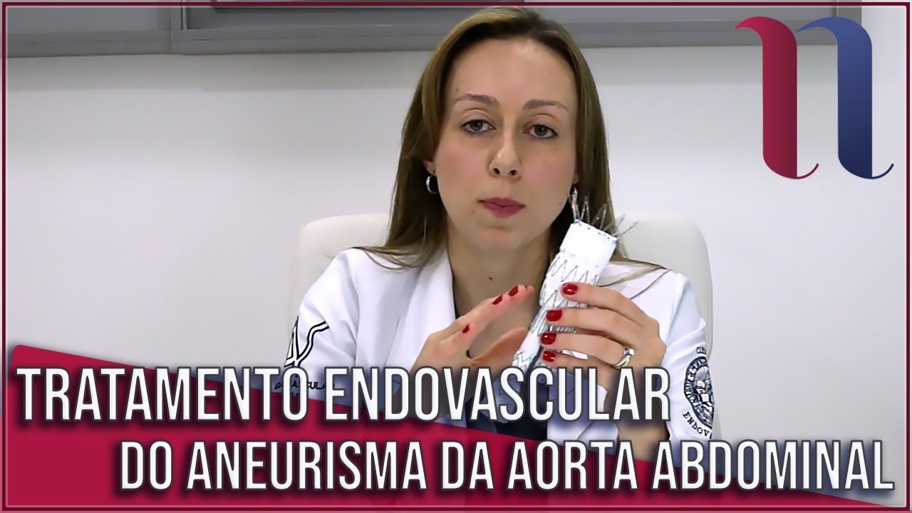 Cirurgia Endovascular para Aneurisma da Aorta Abdominal - EVAR - Dra. Nayara Cioffi Batagini