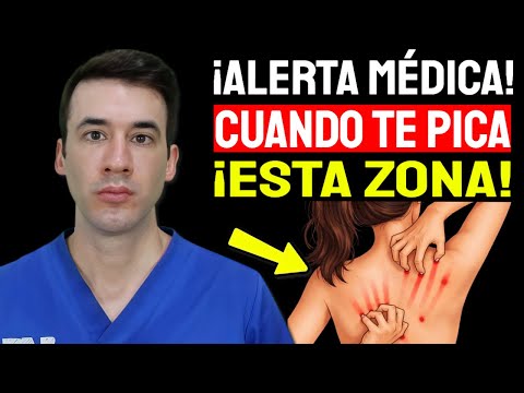 Esa PICAZÓN NO es Normal – Y si PUEDE SER CÁNCER