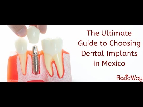 Replace Your Missing Teeth with Dental Implant in Mexico