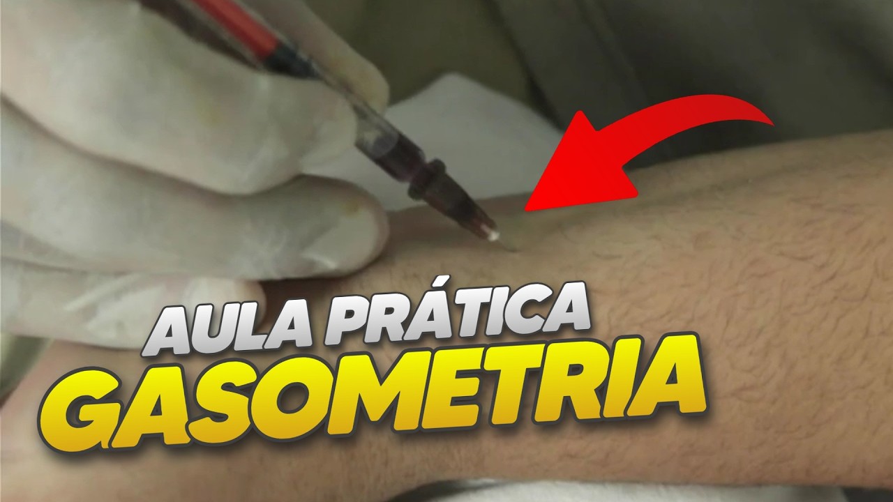 COLETA PRÁTICA DE GASOMETRIA ARTERIAL - COMO COLETAR GASOMETRIA