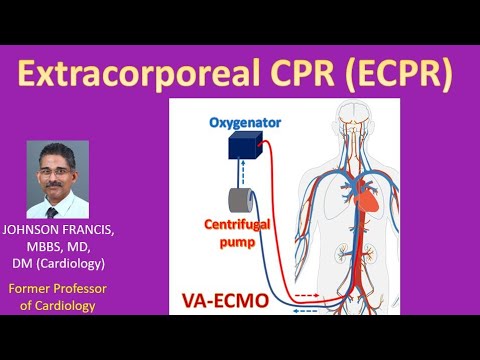 Extracorporeal CPR (ECPR)