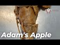 What is the Adam’s Apple? | #shorts
