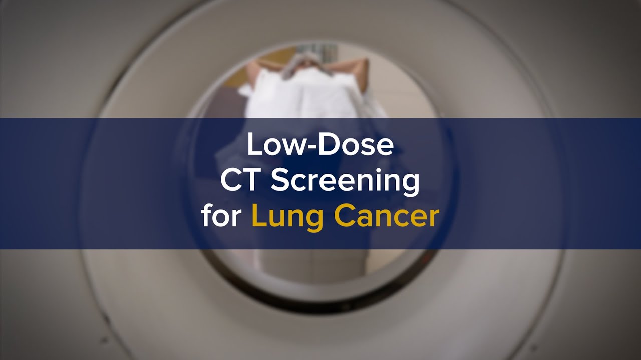 Thumbnail preview of Early Low-Dose CT Screening Key to Curing Lung Cancer Through Advanced Treatment