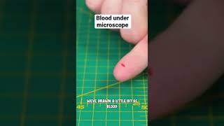 Real blood under microscope is insane!