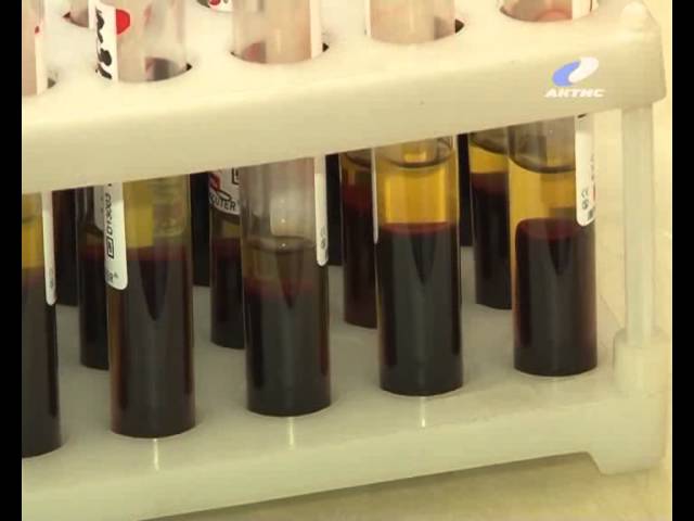 Новое оборудование поступило в перинатальный центр