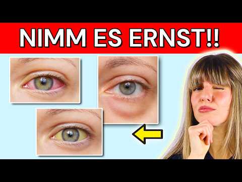 What your eyes reveal about your health (red eyes, meaning)