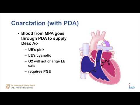 Approach To The Infant With Cyanotic Congenital Heart Disease