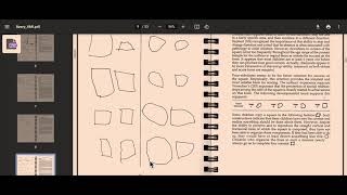 VMI scoring explanation