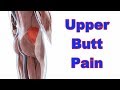 How to Deal with Glute Medius Pain (Sore Butt!)