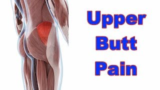 How to Deal with Glute Medius Pain (Sore Butt!)