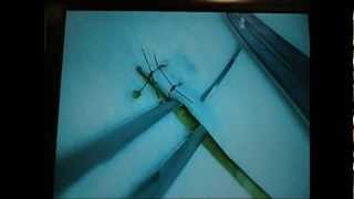Microsurgery Tutorials. Lesson 3: Finesse. Mastering The Feel of Microsurgery. Petal Suture