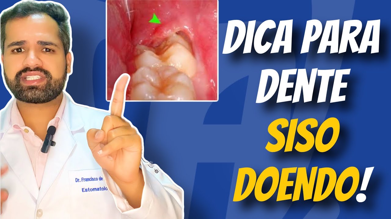 Francisco De Assis Almeida Lima Júnior-90