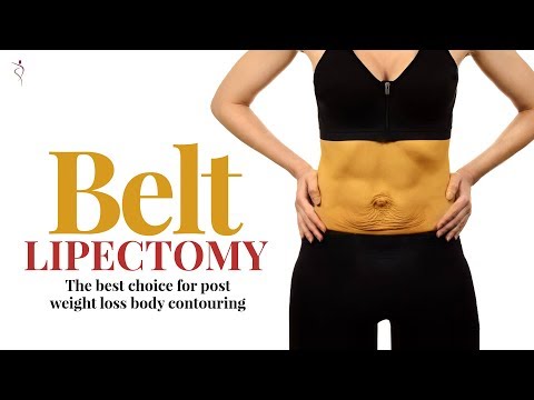 Belt Lipectomy