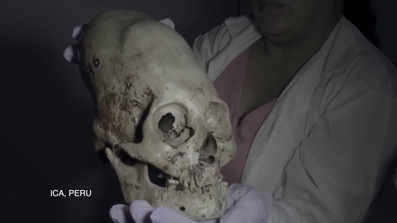 FINALLY: DNA Results Of The Paracas Elongated Skulls Of Peru: 2018