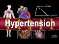 Hypertension High Blood Pressure Animation