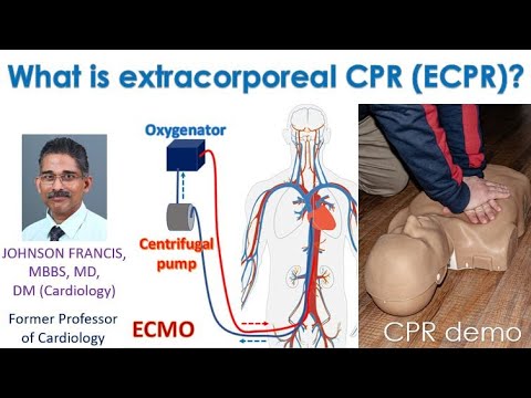 What is extracorporeal CPR (ECPR)?
