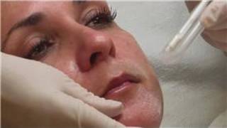 Acne Prone Skin Care : How Do I Peel Skin With Salicylic Acid