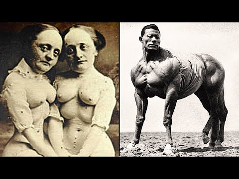 20 Circus Freaks That Actually Existed!