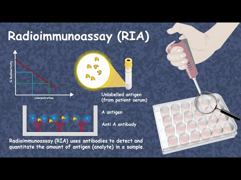Radioimmunoassay( RIA)