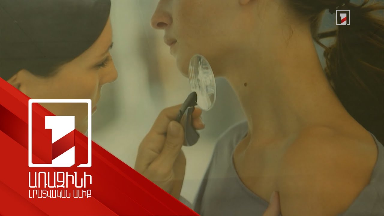 Եթե մելանոման հայտնաբերվում է առաջին փուլում, լիարժեք բուժման հավանականությունը 95%-ից բարձր է