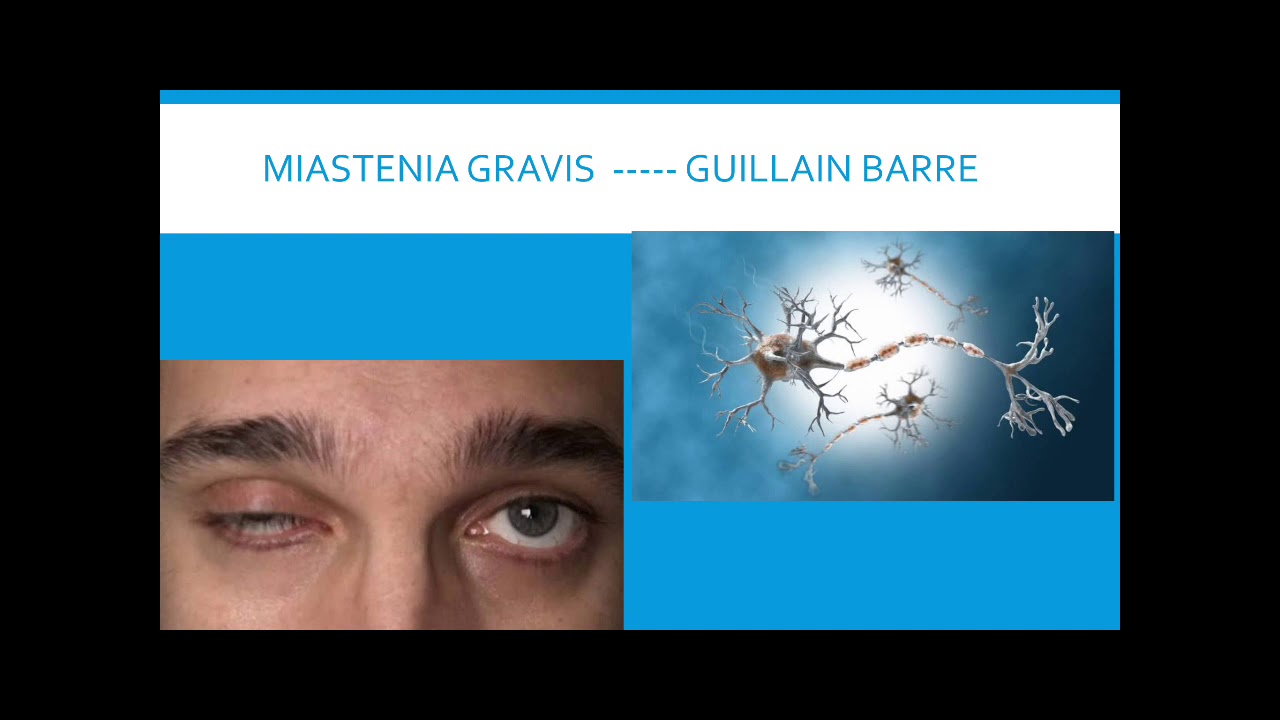 Guillain barre / Miastenia gravis