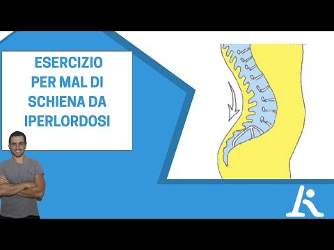 Sono giovane e ho fatto male e crepitare tutte le articolazioni Unguento nel osteocondrosi spalla