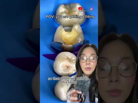 When fixing a cavity, here’s how we make sure your teeth don’t stick together. #cavity #filling
