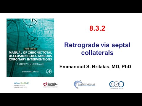8.3.2: Manual of CTO PCI - Retrograde via septal collaterals