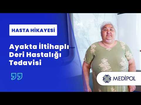 İyileşmeyen Bacak Yarasının Nedeni Pyoderma Gangrenosum Çıktı! | Serpil Hanım'ın Hikayesi