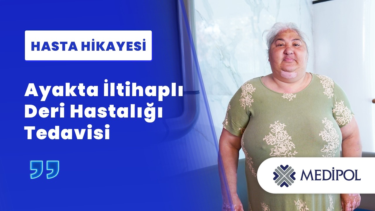 İyileşmeyen Bacak Yarasının Nedeni Pyoderma Gangrenosum Çıktı! | Serpil Hanım'ın Hikayesi