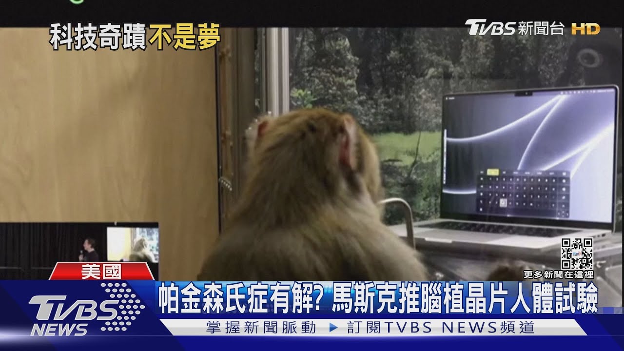 帕金森氏症有解？馬斯克推腦植晶片　拚6個月內人體試驗