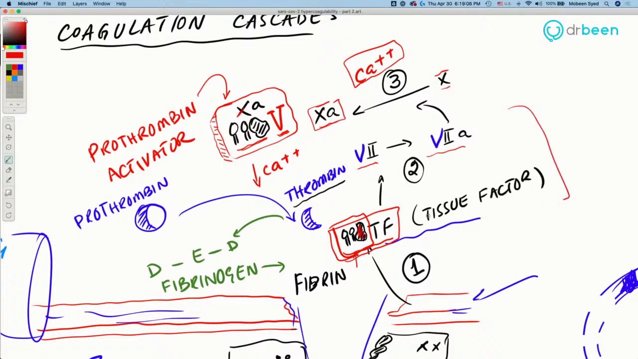 COVID-19 Insights: Hypercoagulability (Clotting) - Part 2 (Coagulation cascade.) - YouTube