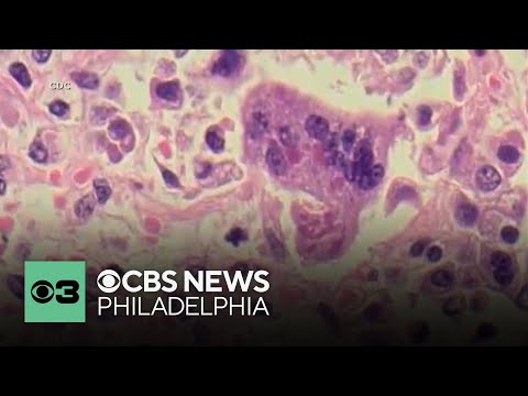 After measles outbreak in Pennsylvania, New Jersey and Delaware, health officials renew warnings