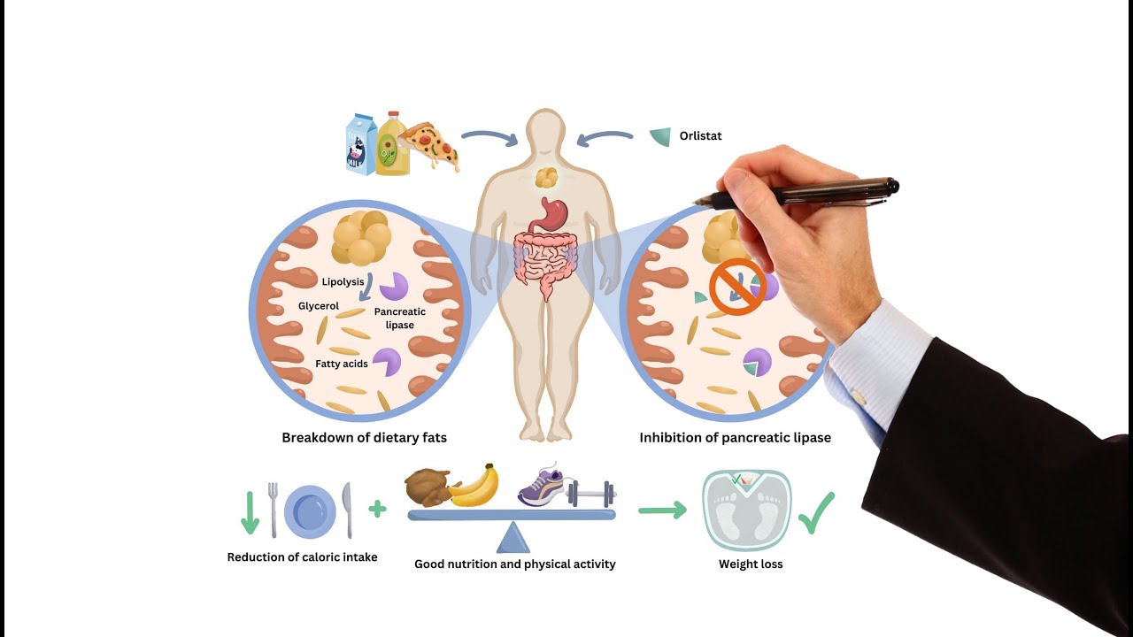 Pharmacology - WEIGHT LOSS DRUGS FOR OBESITY (MADE EASY)