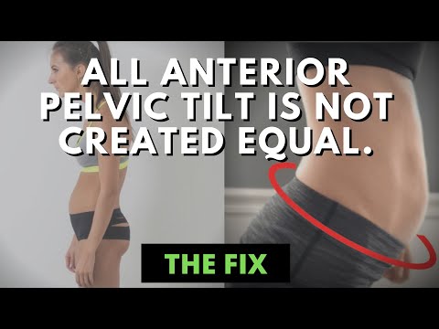How We Compensate Into Anterior Pelvic Tilt & How to...