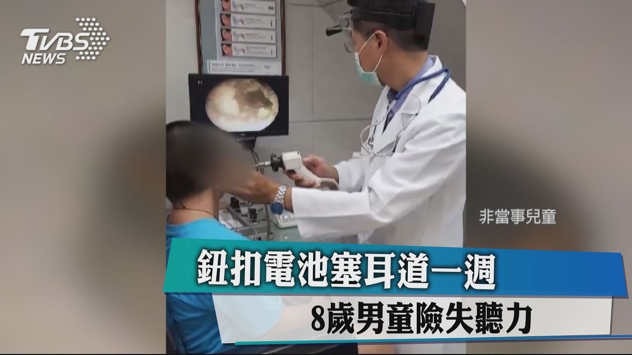 鈕扣電池塞耳道一週 8歲男童險失聽力