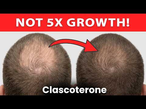 539% Hair Growth?! Clascoterone 5% 2026 Update
