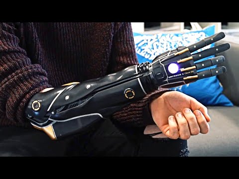 image-How fast are bionic arms?