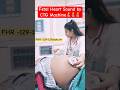 Fetal Heart Sound By CTG Machine Routine Care