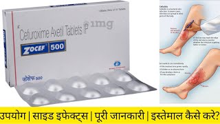 Zocef 500 Tablet | Powerful Antibiotic for Infection Treatment | Uses, Dose, Side Effects in Hindi