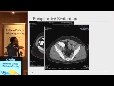 V Kalles - COLORECTAL CANCER, Interactive Case Presentations