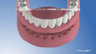 Vitaldent Prótesis Dental Removible anuncio